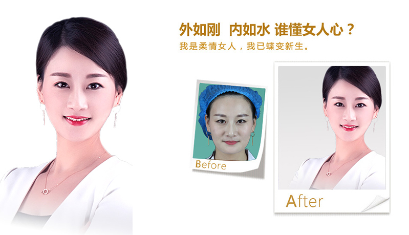 大连V脸、线雕隆鼻